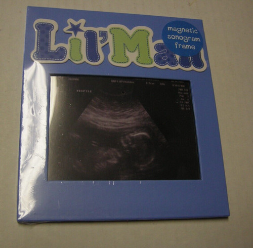 Sonogram magnetic frame - sonogram, by