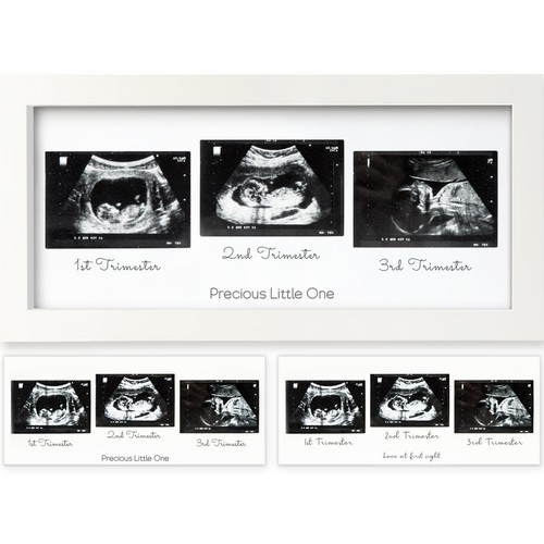 Keababies baby sonogram - baby,