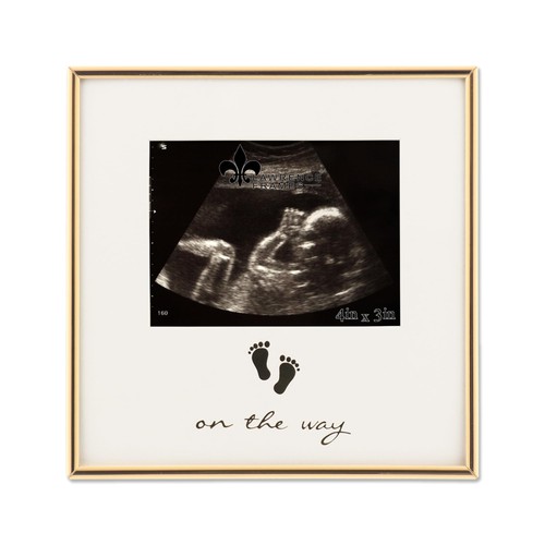 5x3 sonogram ultrasound - sonogram, gold